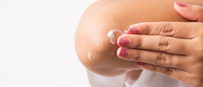 Hand applying moisturizing cream to a dry, flaky elbow.